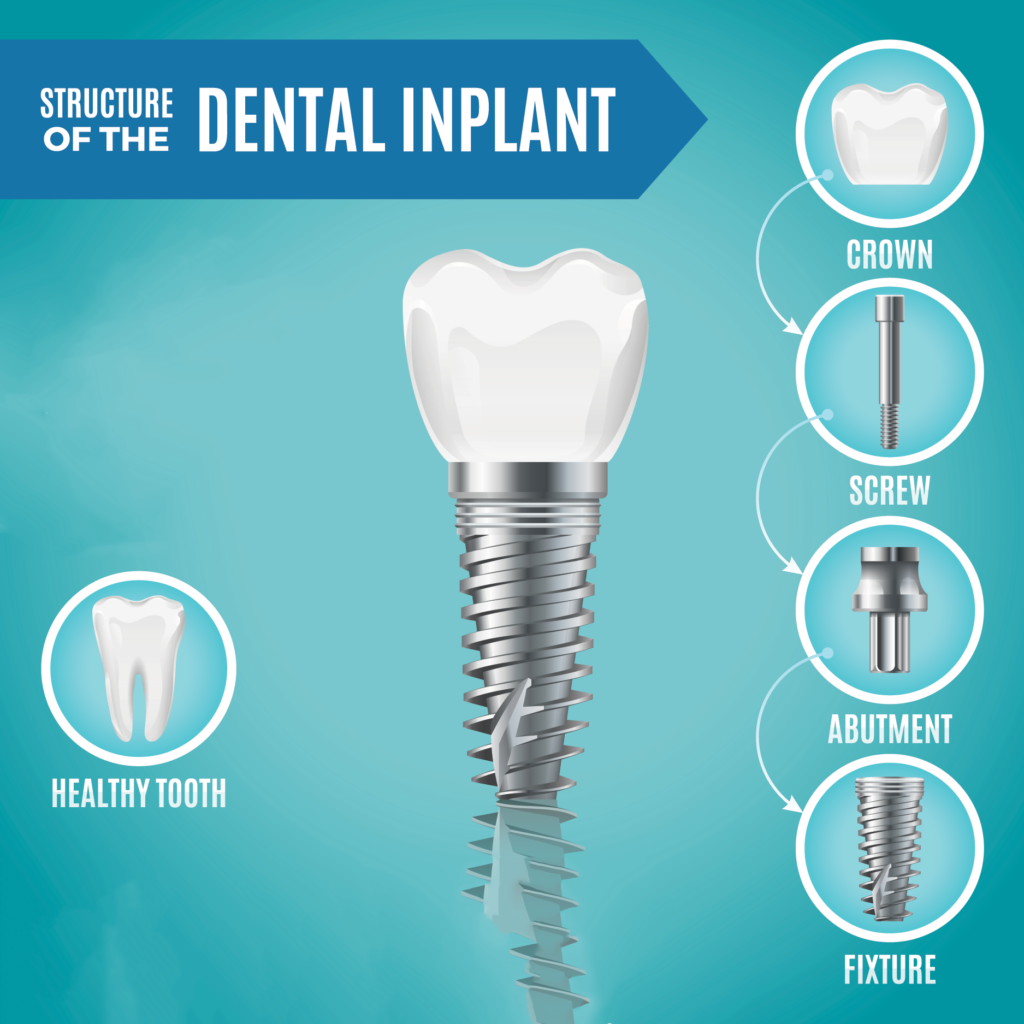 DENTAL IMPLANTS in Wayne, PA could help you restore missing teeth in your mouth